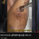 블랙컴뱃 비상 .. 김재웅 상대 김대환 부상 아웃...gif 이미지