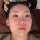 초석빌딩 | 대구 두피관리 미모에스테틱에서 두피 스케일링 받은 후기