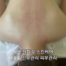 궁동초등학교 | [익산] 부송동피부관리 신부관리 최화정스킨케어