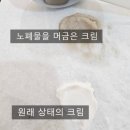 멍케어 | 허벅지 지방흡입 고주파관리로 붓기 멍 케어후기
