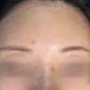 노즈랩의원 이미지