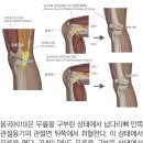 침금동인으로 복원한 18세기 조선의 표준경혈 9 : 곡천, 음곡혈 이미지