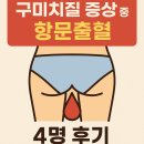 봉곡동386 | 구미치질 증상 중에서 항문출혈 4명 후기