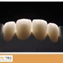 율치과기공소 이미지