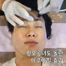 전주 류스킨앤바디 아쿠아필 후기 | 왕모공녀의 피부결 변화