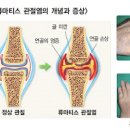 검지손가락 마디 통증 부음 떨림 저림 원인 이미지