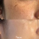 올리하이 이미지