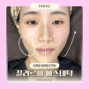 대구 동구 피부관리실 장원영 알테온 리프팅 끌라르떼 에스테틱 땅콩형 윤곽관리 후기