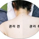 고아라스킨케어 이미지