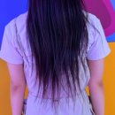한살 | 365mc 밉살주사 한 달 후기 팔뚝살 효과