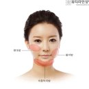 브이라인