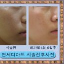 레가토 이미지