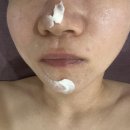 임정미에스테틱 | 대전에스테틱 임정미에스테틱 얼굴축소 윤곽관리 후기