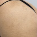 스킨52부천지부 이미지