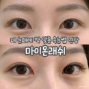 마이온뷰티My-on | 대구 속눈썹 연장 꼼꼼한 관리 유지력 좋은 마이온래쉬