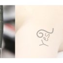 신레이저 이미지