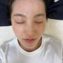 마일드네일 - 연제구 | 광주플라즈마 추천 멜로우왁싱 상무점 마일드플라즈마 후기