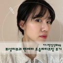 화성에너지 | 화성피부과 얼굴 초음파 리프팅 텐쎄라 찐 후기