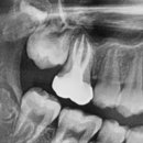 수원탑플란트치과의원 이미지