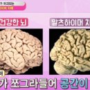 싱긋보청기 네이버블로그
