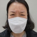 오라클성형외과의원 | 비립종 압출 &amp; 미간, 눈가 보톡스 후기-오라클 성형외과 수원망포점(가격정보 포함).