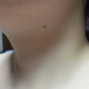 혹부리한의원 이미지