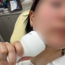 썸블리의원 | 인천 구월동 <썸블리의원> 블리브이 지방분해주사 20cc 내돈내산 후기