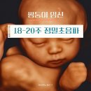 네일미떼 | 쌍둥이 임신 18-20주차 일상 | 태아정밀초음파, 태교여행 면세구매리스트, 태아보험가입