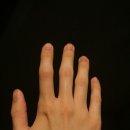 대상체르니 이미지