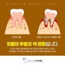 덕신치과 네이버블로그