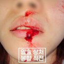 강동실비 이미지