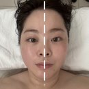 상나운1길 | 군산 피부 윤곽관리 잘하는 곳 레이드스킨 리프팅 관리 후기