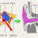 독일탑보청기 이미지