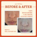 에이블케어 | 에이블메디스킨 인천부평역 피부관리 장단점 솔직후기