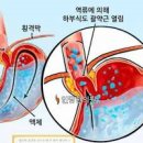 왼쪽 심장 찌릿 가슴 찌릿 통증 가슴밑찌릿 정리 이미지