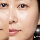 나노필의원 | 엑소좀 스킨부스터 효과, 부작용 완벽 분석! 피부과 가기 전 필독 가이드