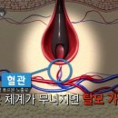 지방 섭취 부족 증상 5가지 이미지