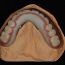 엘리트치과기공소 이미지