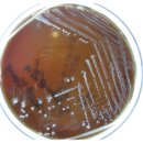 BAP(Candida albicans) 성장 형태 이미지