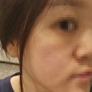 수경피부과 | 강남역 피부과 올리지오 후기, 써마지랑 효과, 가격차이 정리