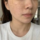 자작나무힐 | 자작나무 수분선크림 순한 유기자차 무기자차 선크림 추천 후기