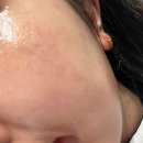 주향교회 | 광주피부관리 봉선동에스테틱 인셀덤주향점 제품 솔직후기