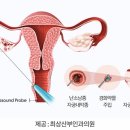 난손