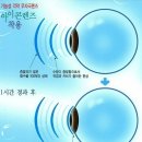 안경에반하다 이미지