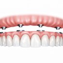 e웰니스치과의원 이미지