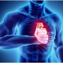 독일 렉스톤 보청기 이미지