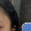 청담한의원 | 한의원 후기 – 청담 압구정 근처 체형교정과 통증치료 리뷰