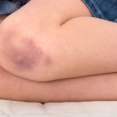 블루약국 이미지