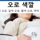 출산 후 오로 언제까지 (냄새, 색깔, 자연분만 제왕) 이미지