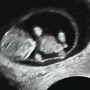 전보미 카카오 검색결과